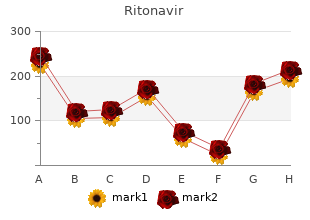 order ritonavir on line amex