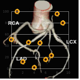 Spondyloepimetaphyseal dysplasia